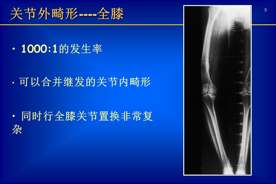 关节外畸形全膝课件.ppt_第3页