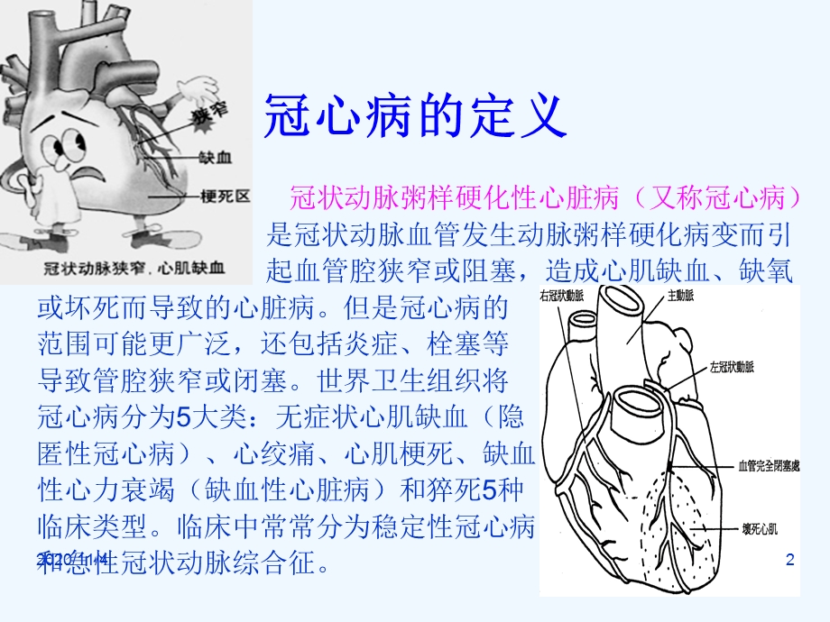 冠心病的社区预防课件.ppt_第2页