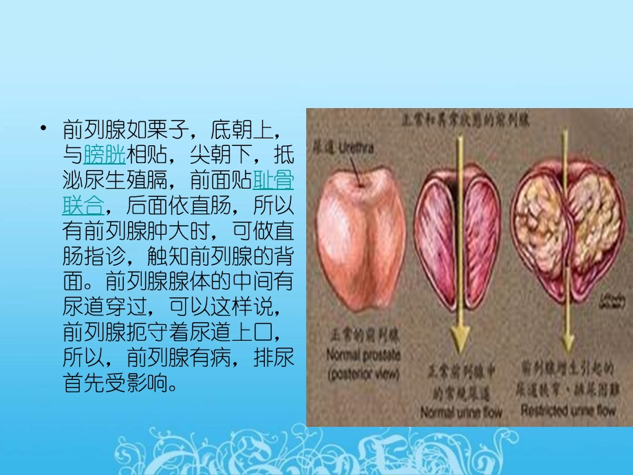 前列腺电切手术前后的注意事项主题讲座课件.ppt_第2页