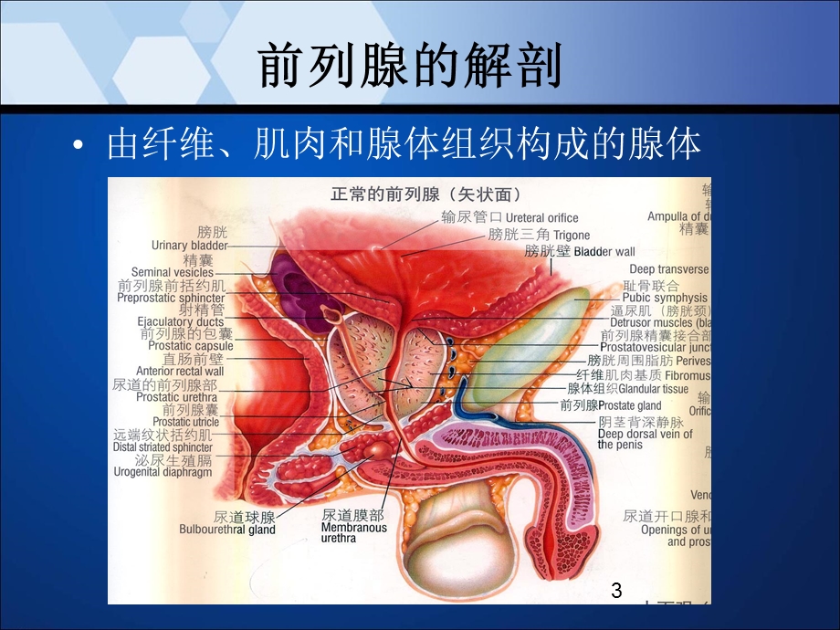 前列腺增生及前列腺癌的磁共振诊断及波谱分析课件.ppt_第3页