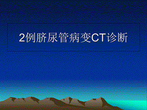 例脐尿管病变CT诊断解析课件.ppt