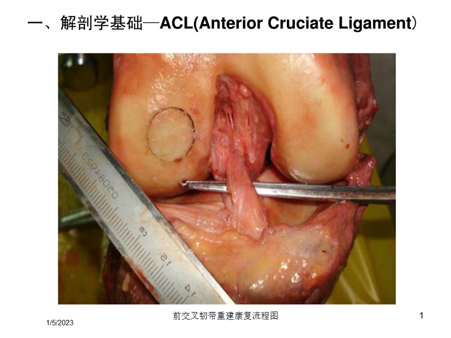 前交叉韧带重建康复流程图培训课件.ppt_第1页