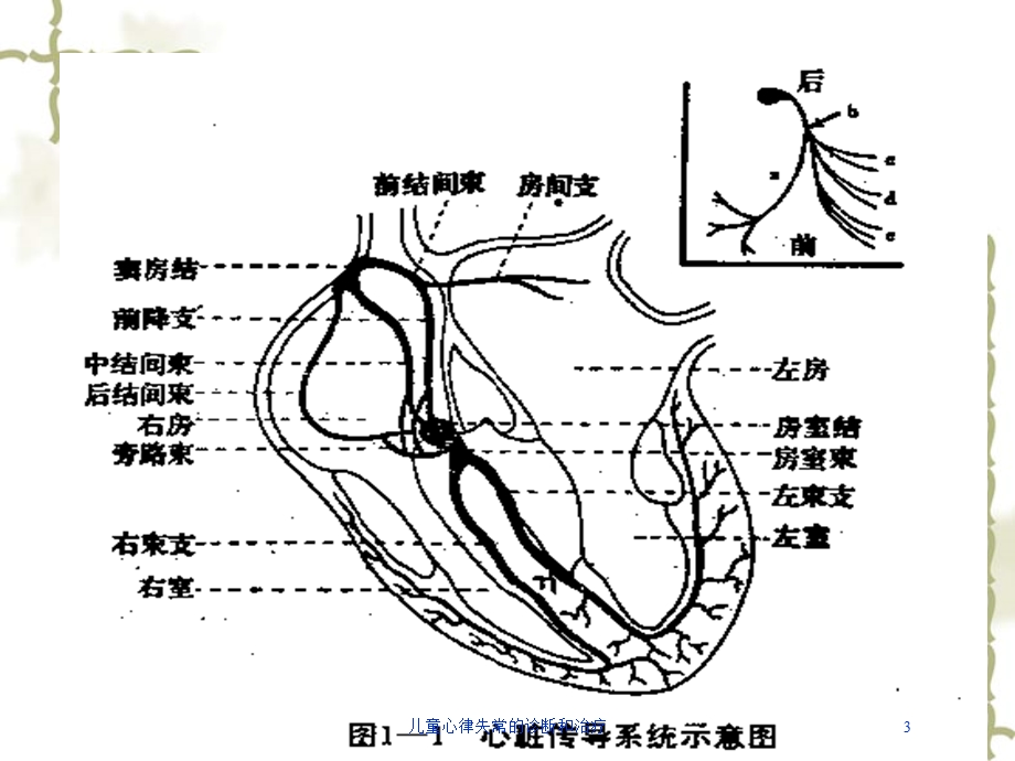 儿童心律失常的诊断和治疗培训课件.ppt_第3页