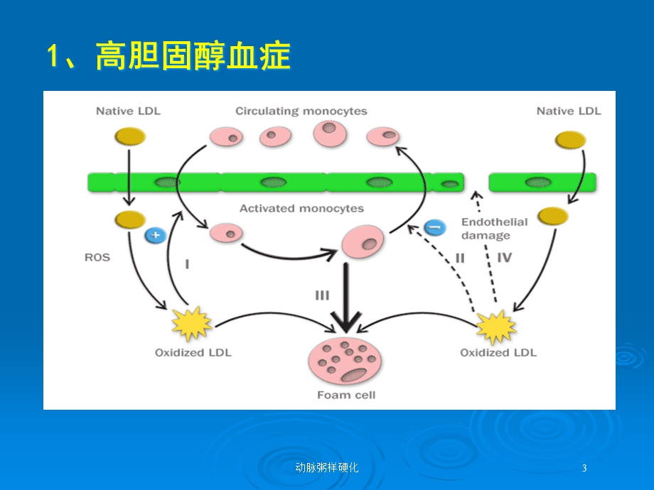 动脉粥样硬化培训课件.ppt_第3页