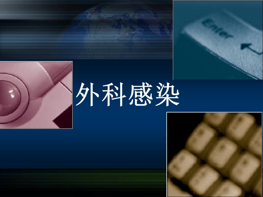 《外科感染》PPT课件.ppt_第1页