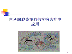 内科胸腔镜课件.ppt