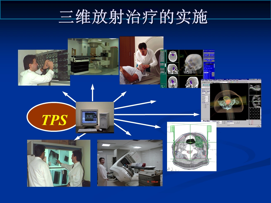 光子束外照射治疗计划系统课件.ppt_第3页