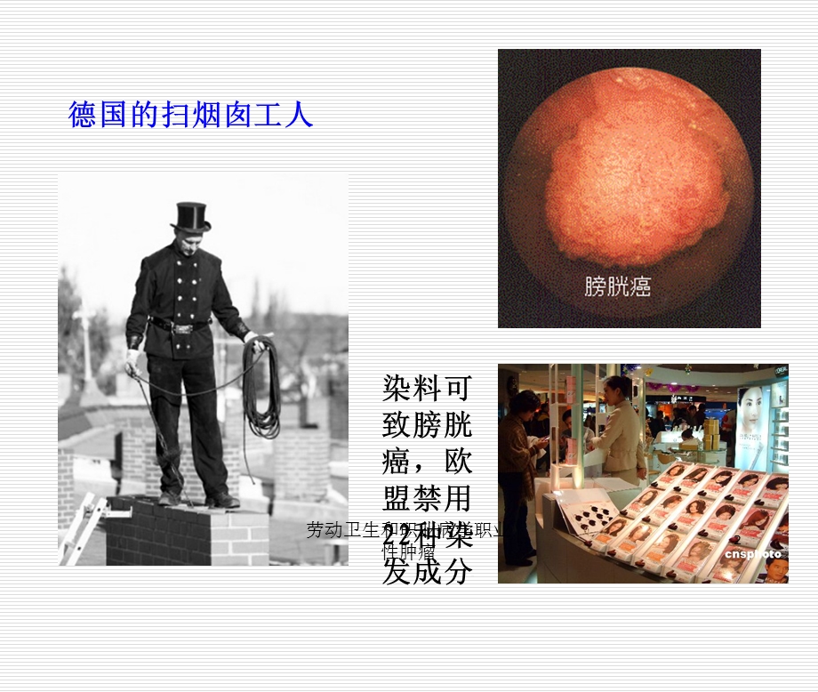 劳动卫生和职业病学职业性肿瘤培训课件.ppt_第2页