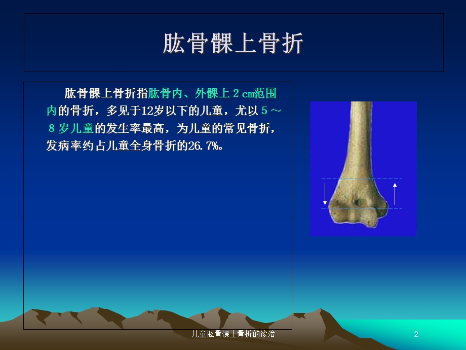 儿童肱骨髁上骨折的诊治培训课件.ppt_第2页