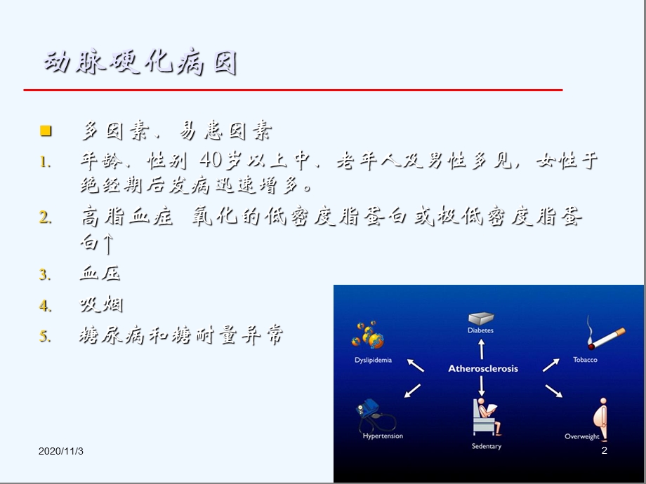 冠心病的介绍课件.ppt_第2页