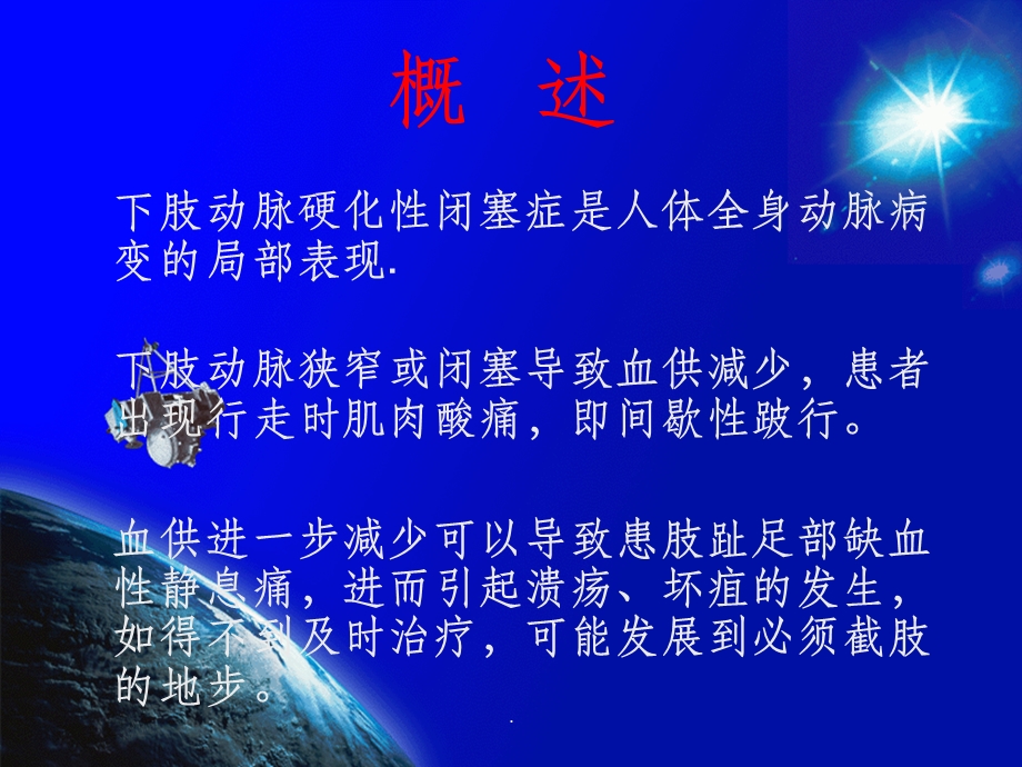 下肢动脉缺血的介入治疗ppt课件.ppt_第2页