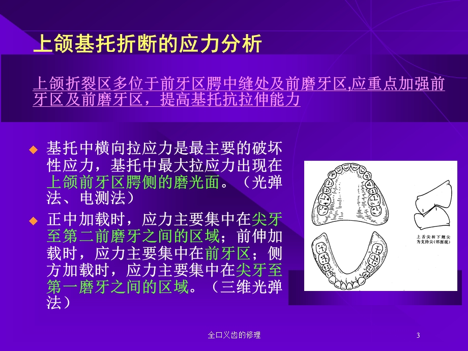 全口义齿的修理培训课件.ppt_第3页