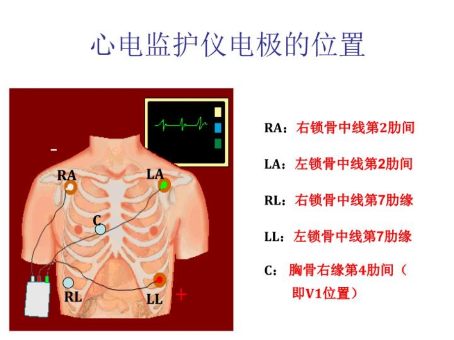 六讲心律失常课件.ppt_第3页