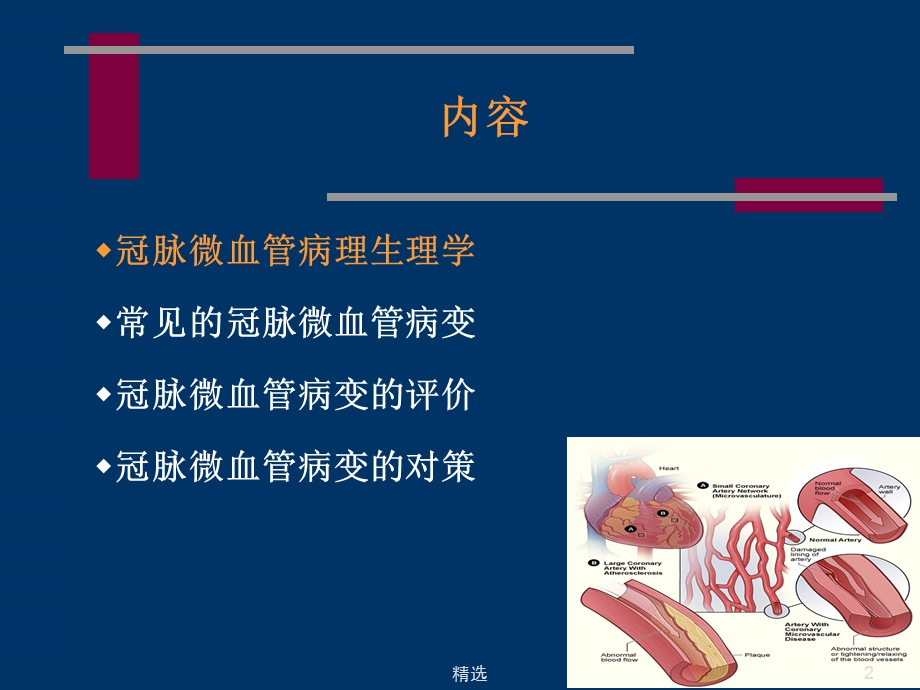 冠状动脉微血管病变和对策课件.ppt_第2页