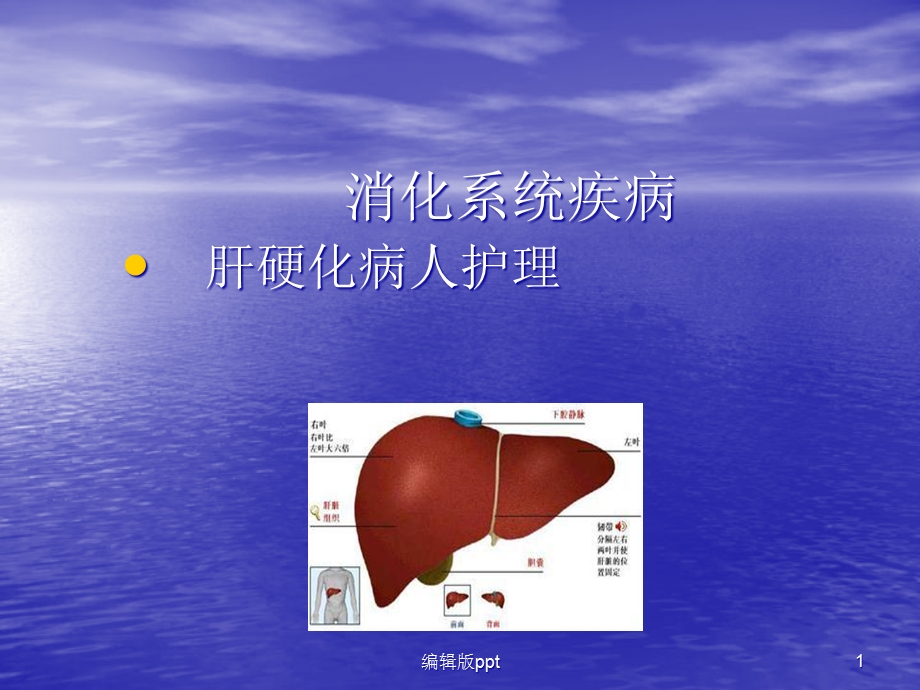 内科护理学肝硬化课件.ppt_第1页