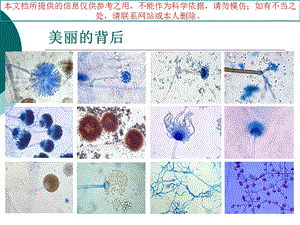 侵袭性真菌感染诊疗和治疗培训课件.ppt