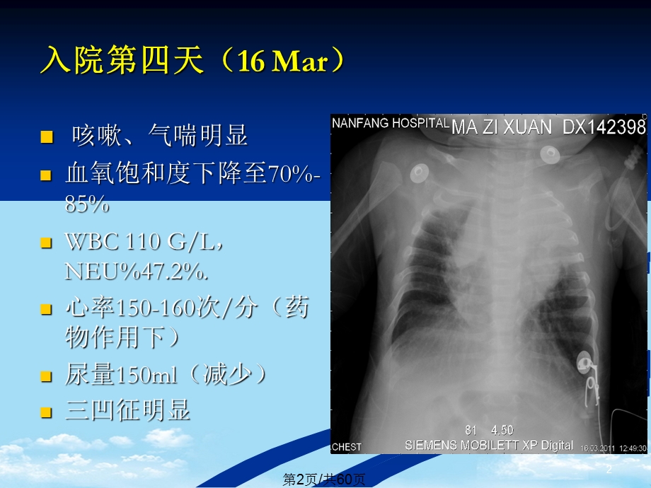 儿科肺炎全面版课件.pptx_第2页