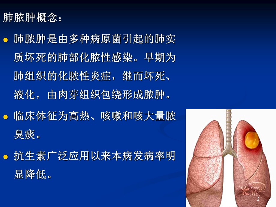 内科护理学肺脓肿课件.ppt_第2页