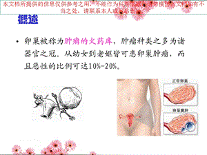 卵巢囊肿专业知识讲座培训课件.ppt