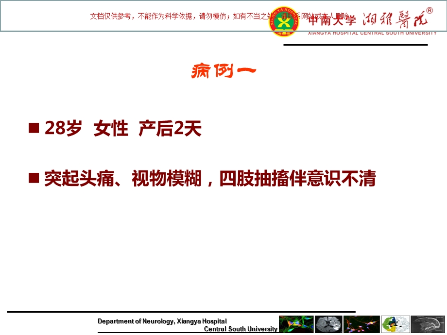 可逆性后部脑病综合征课件.ppt_第1页