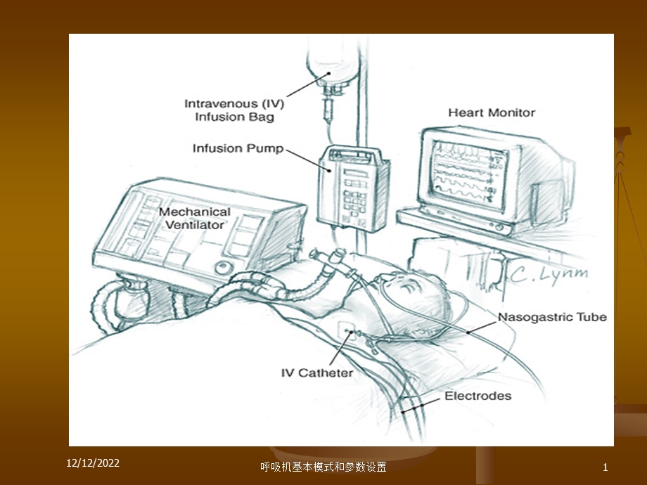 呼吸机基本模式和参数设置课件.ppt_第1页