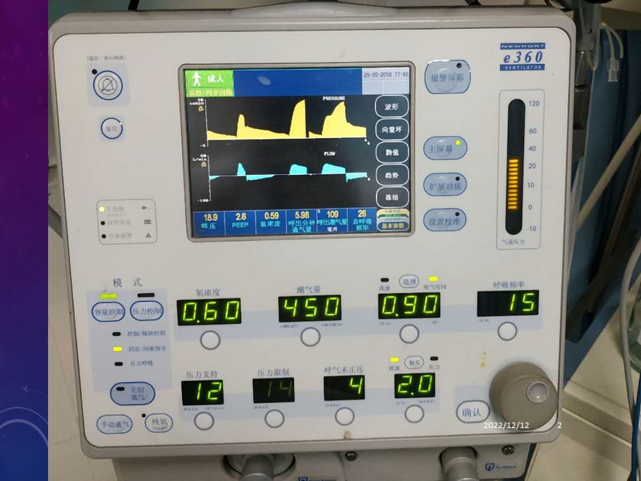 呼吸机常用模式参考课件.ppt_第2页
