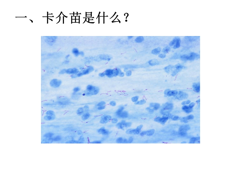 卡介苗接种技术讲解课件.ppt_第3页