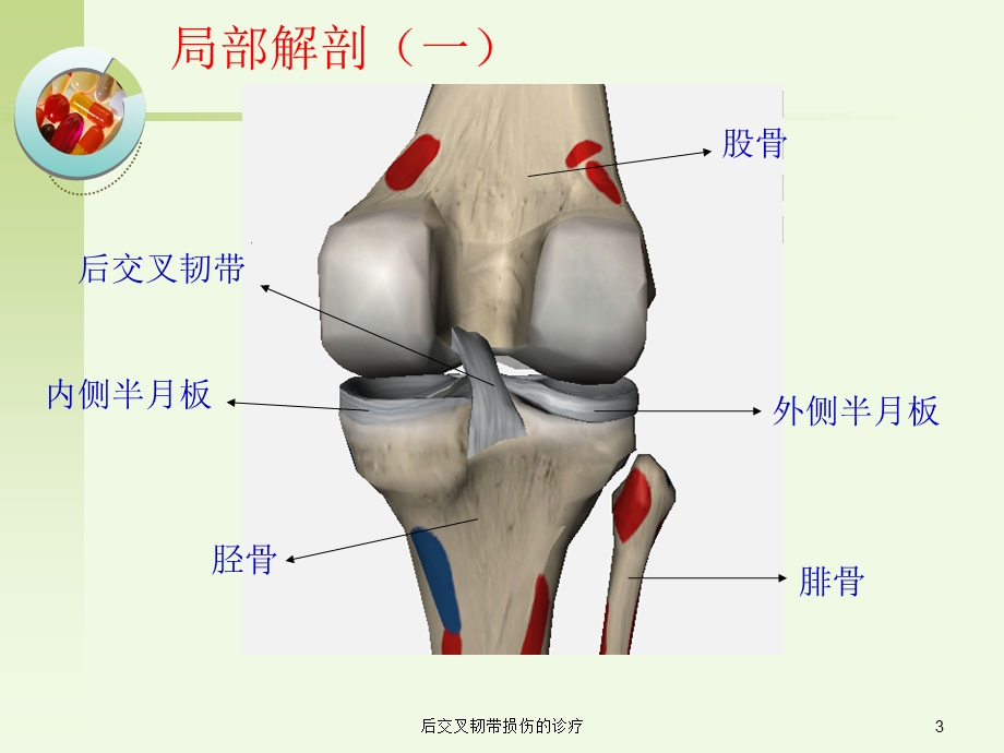 后交叉韧带损伤的诊疗培训课件.ppt_第3页