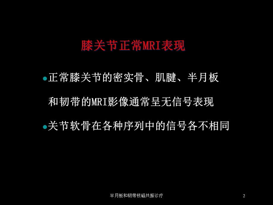 半月板和韧带核磁共振诊疗培训课件.ppt_第2页