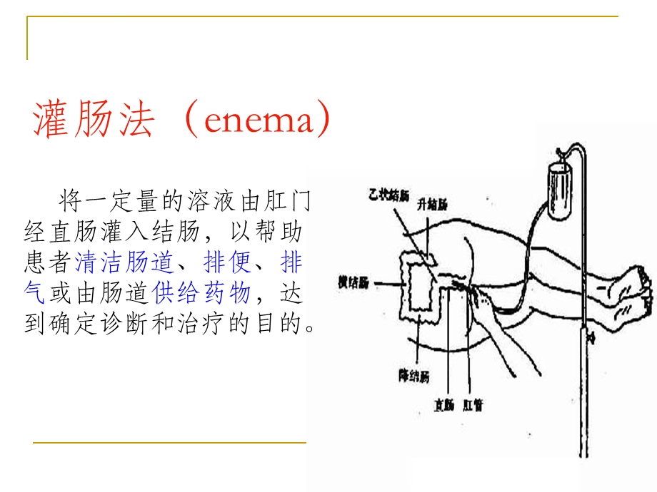 保留灌肠法ppt课件.ppt_第2页