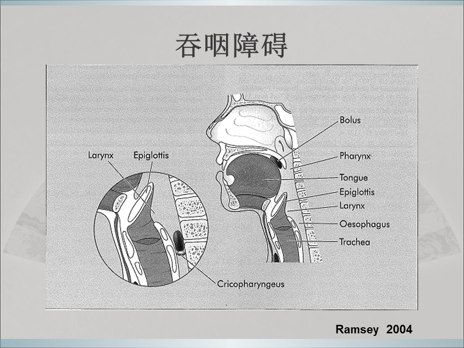 吞咽障碍与治疗课件.pptx_第3页