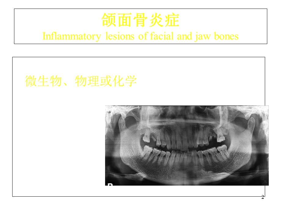 口腔影诊颌骨炎症大课课件.ppt_第2页