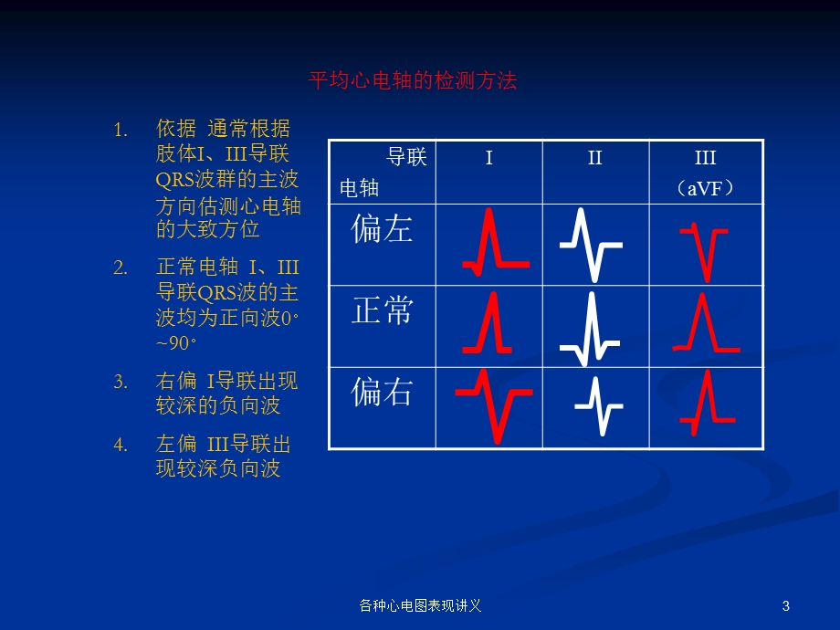 各种心电图表现讲义培训课件.ppt_第3页