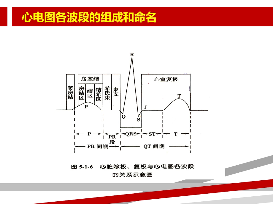 十二种心律失常课件.ppt_第3页