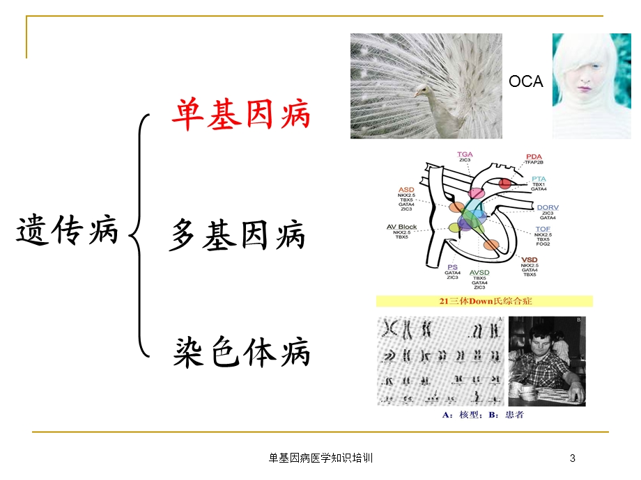 单基因病医学知识培训培训课件.ppt_第3页