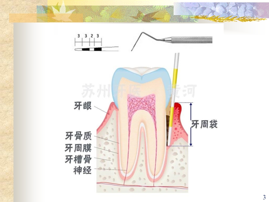 口腔内科学5牙周组织病课件.ppt_第3页