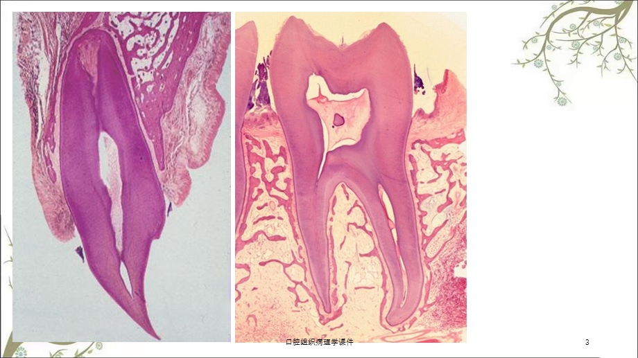 口腔组织病理学课件.ppt_第3页