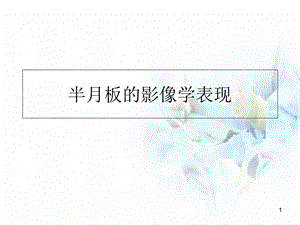 半月板的影像学表现医学课件.ppt