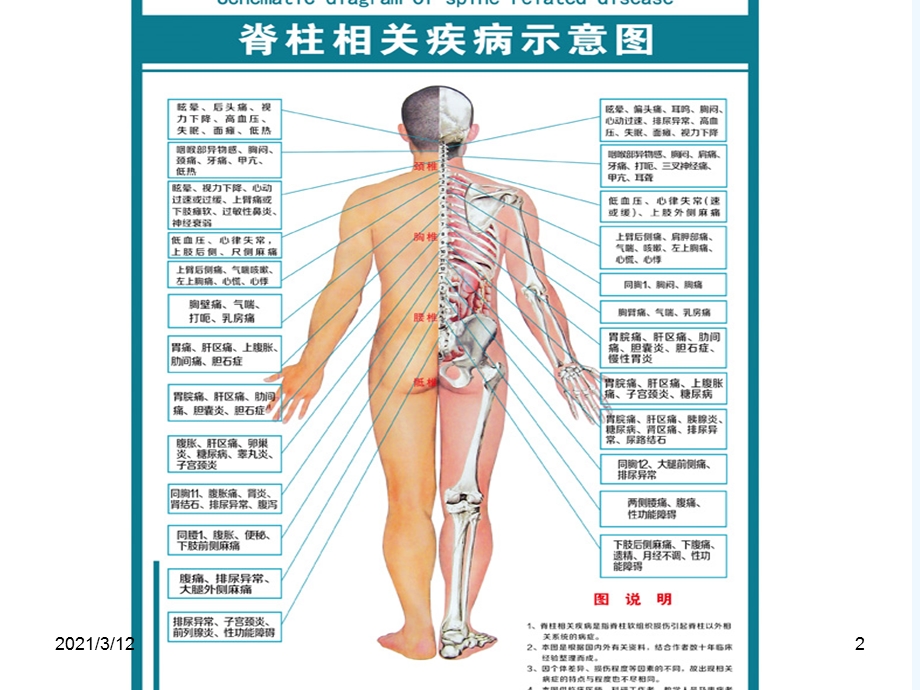 史上脊柱与疾病关系并附歌诀课件.ppt_第2页