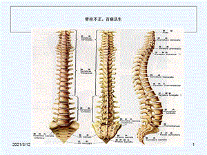 史上脊柱与疾病关系并附歌诀课件.ppt
