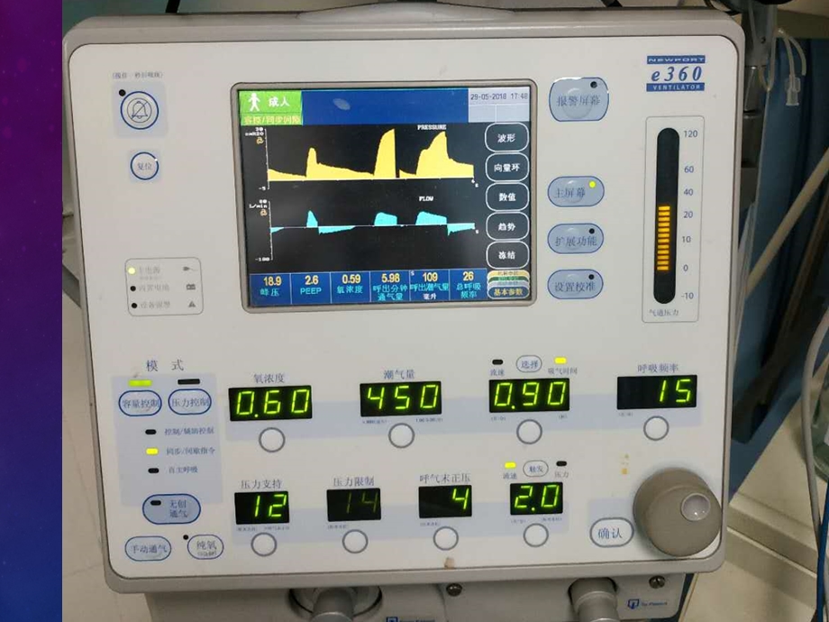 呼吸机常用模式课件.ppt_第2页