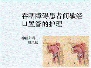 吞咽障碍护理课件.ppt