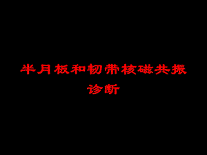 半月板和韧带核磁共振诊断培训课件.ppt