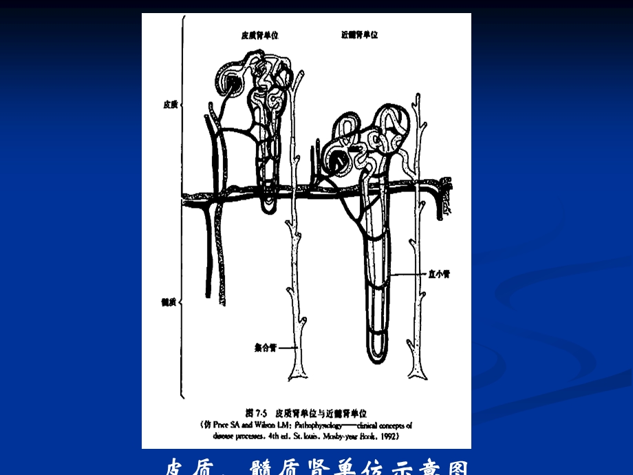 十八章肾功能不全课件.ppt_第3页