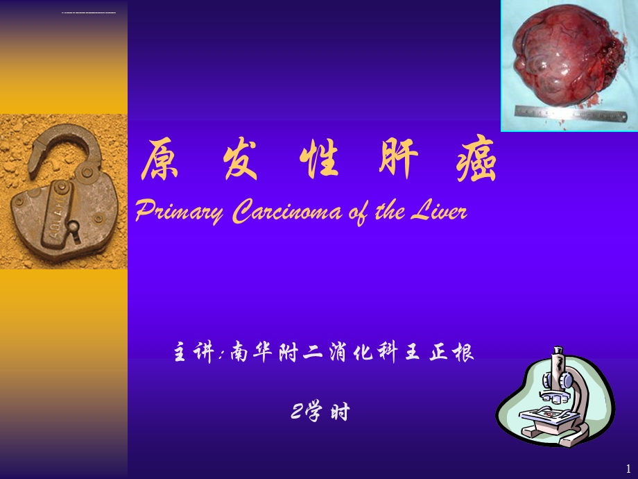 原发性肝癌(课堂ppt)课件.ppt_第1页