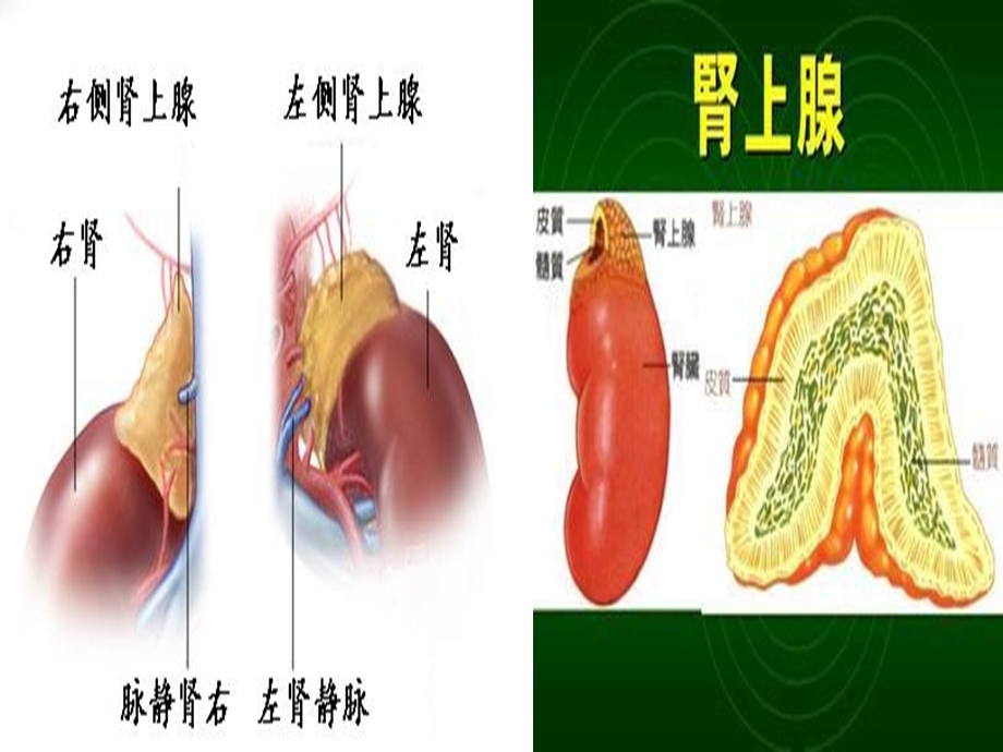 后腹腔镜肾上腺肿瘤切除术ppt课件.ppt_第3页