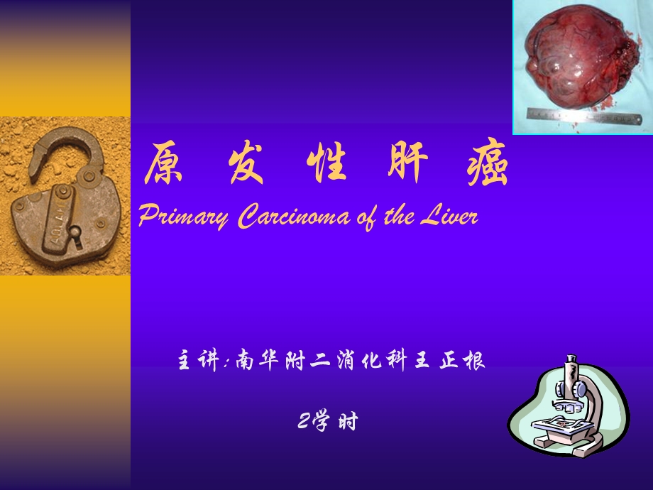 原发性肝癌ppt课件.ppt_第1页