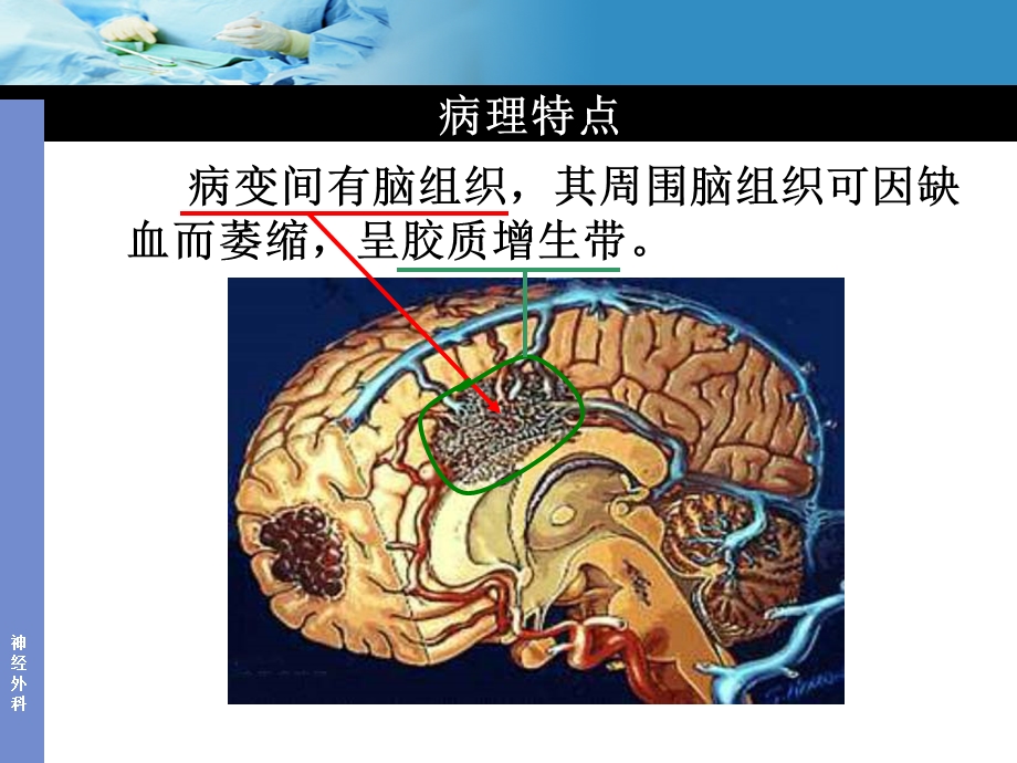 动静脉畸形AVMppt课件.ppt_第3页