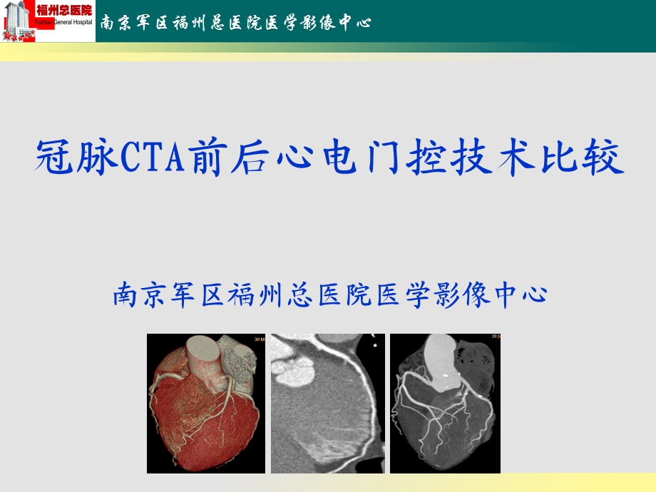 冠脉CTA前后心电门控技术比较ppt课件.ppt_第1页