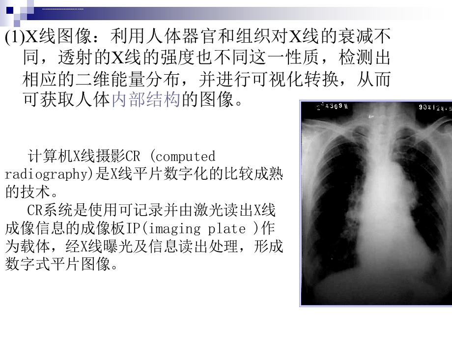 医学影像处理图像处理ppt课件.ppt_第2页